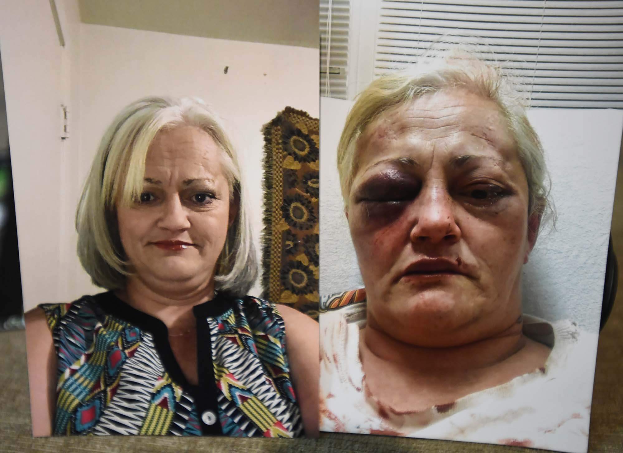 Cheryl Baier felt one of her eyes come loose after what seemed like 20 blows.